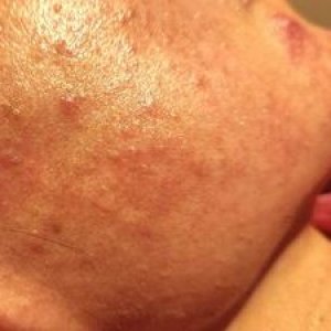 汗と紫外線で、肌ボロボロ⁉