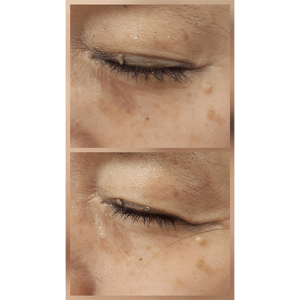 展示会で、Before →After が凄い！